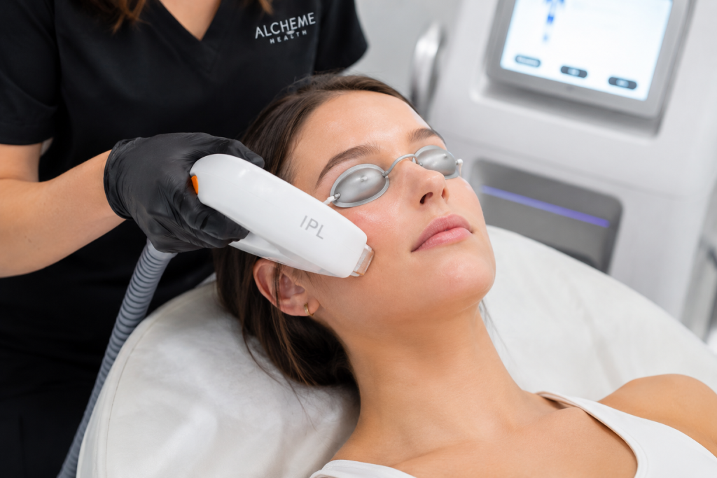 IPL treatment targeting sun damage, redness, and uneven skin tone for a brighter complexion.